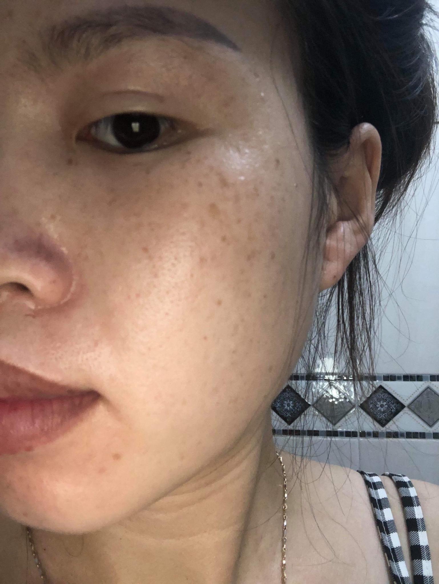 Cỏ trị nám, tàn nhang Lý Gia .