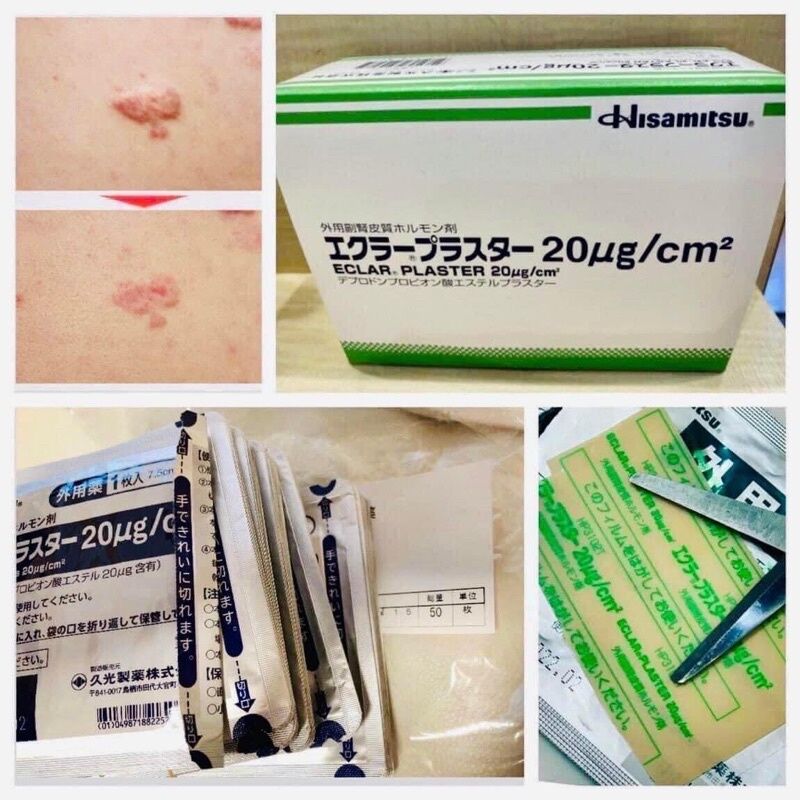 Miếng Dán Ép Sẹo Lồi Eclar Plaster Hisamitsu Nhật Bản 1 túi - Q Cosmetics