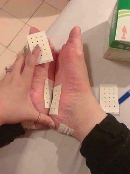 Cao dán NEOBUN Thái Lan