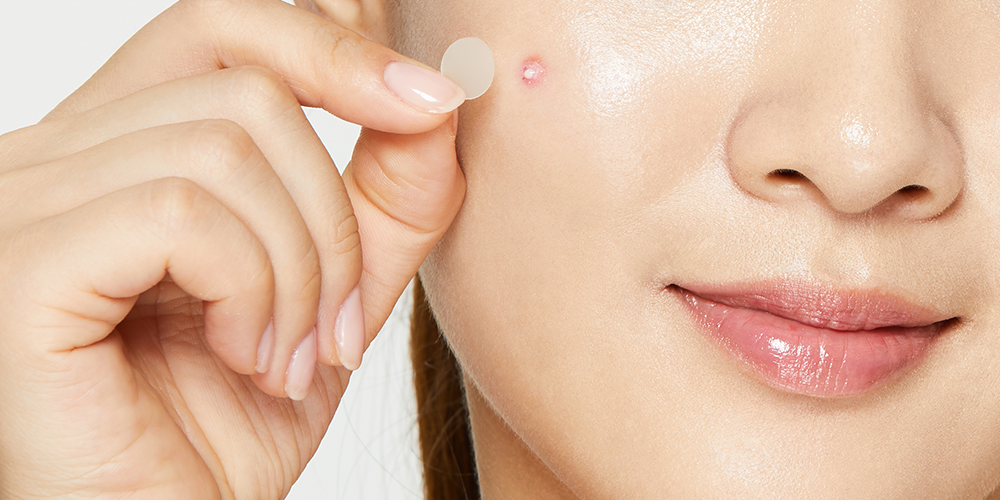Miếng Dán Trị Mụn Ciracle Red Spot Acne Pimple Patch Hàn Quốc