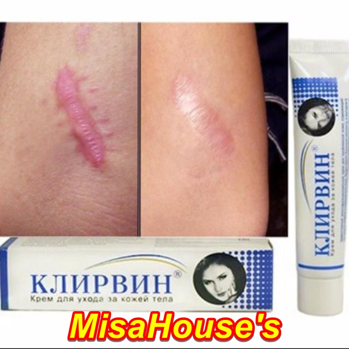 Mờ sẹo Nga Klirvin hiệu quả tức thì