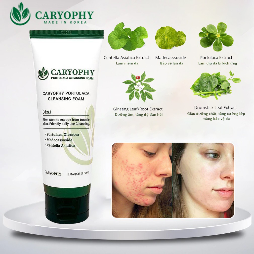Bộ 3 Sản Phẩm Caryophy Portulaca Mini Size (Tẩy trang 60ml + Sữa rửa mặt 30ml + Toner 50ml)