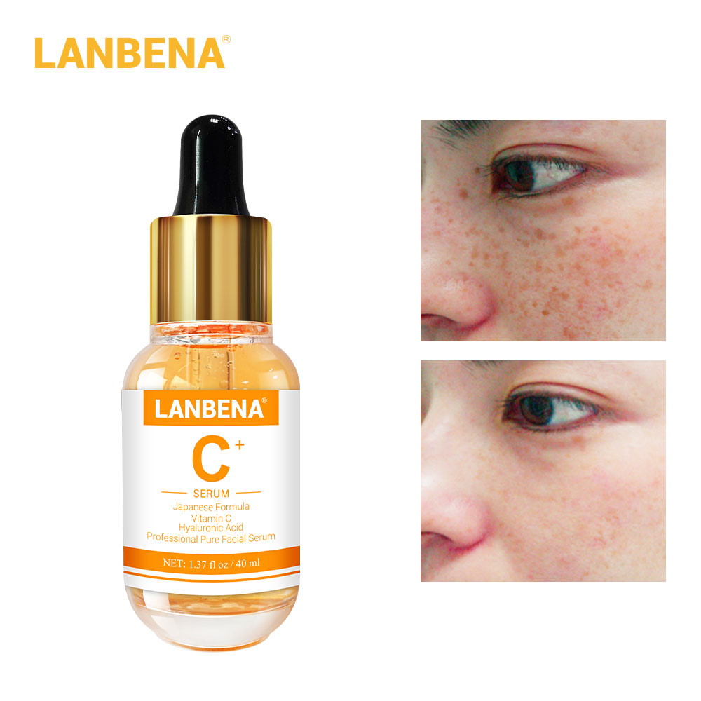 LANBENA Serum Vitamin C Niacinamide Hyaluronic Acid Dưỡng ẩm Dưỡng Trắng Da Trị Mụn Vitamin C Serum Acne Treatment Hyaluronic Acid Serum Whitening Moisturizing