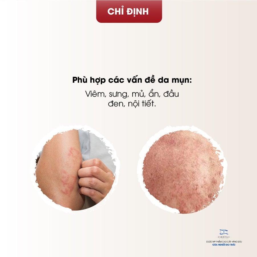 Serum Cấp Ẩm Cho Da Mụn Christina Comodex Hydrate & Restore Serum