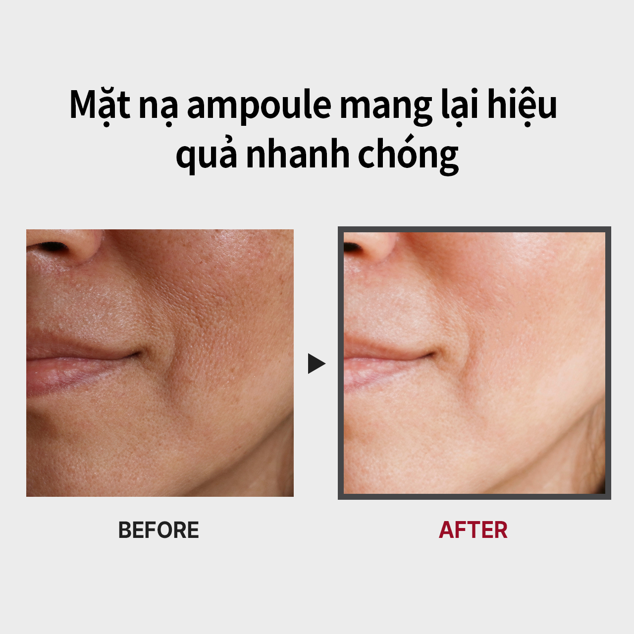 [MEDIPEEL Official] BIO-INTENSE GLUTATHIONE WHITE AMPOULE MASK