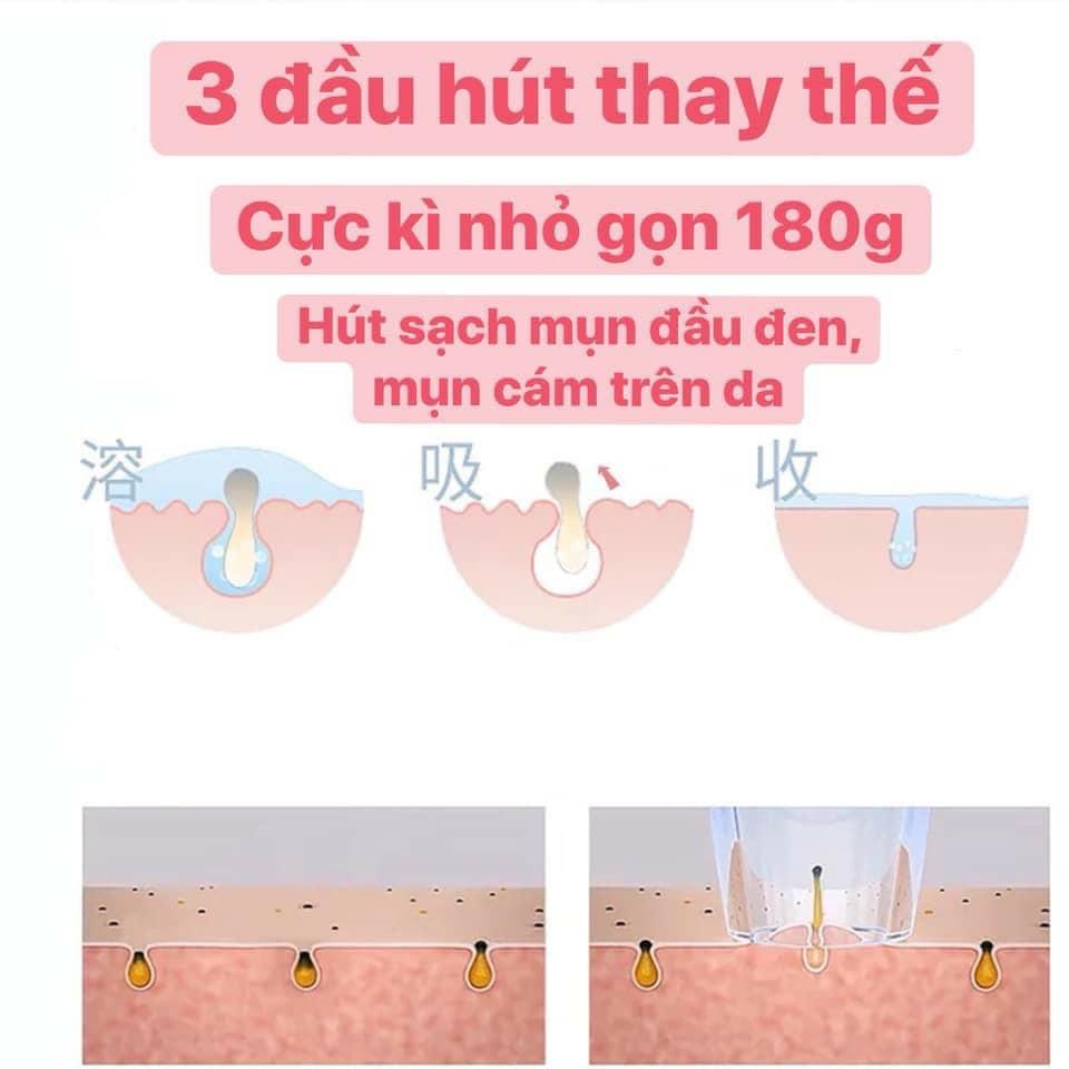 Máy hút mụn mẫu mới cho các chị em