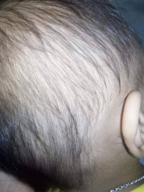 SỮA TẮM LÁ KHỔ QUA RỪNG MẸ KEN
