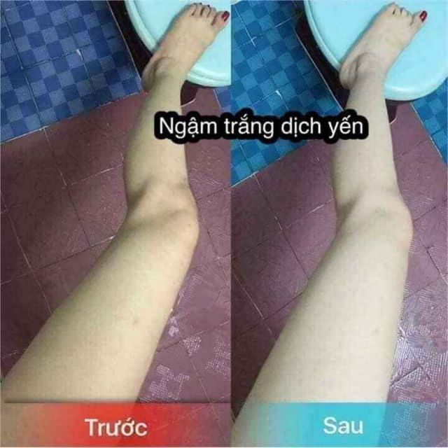 ngậm trắng dịch yến chuyên sỉ spa