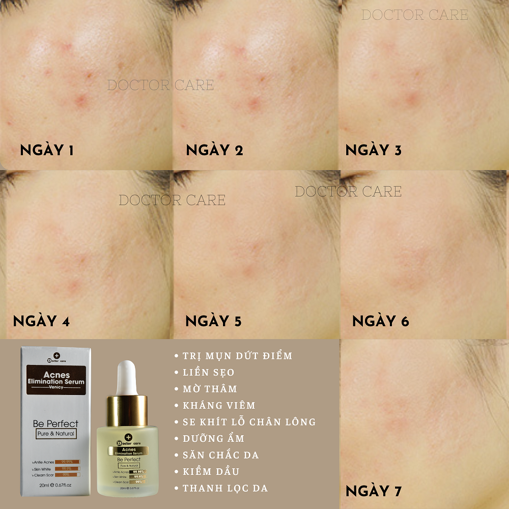 Serum tri Mụn Bọc tận gốc  Doctor Care