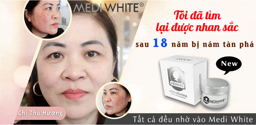 [HCM]Kem Giảm Nám Trắng Da Medi White Face