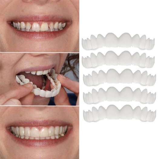 Răng Giả Snap On Smile Kmdeal