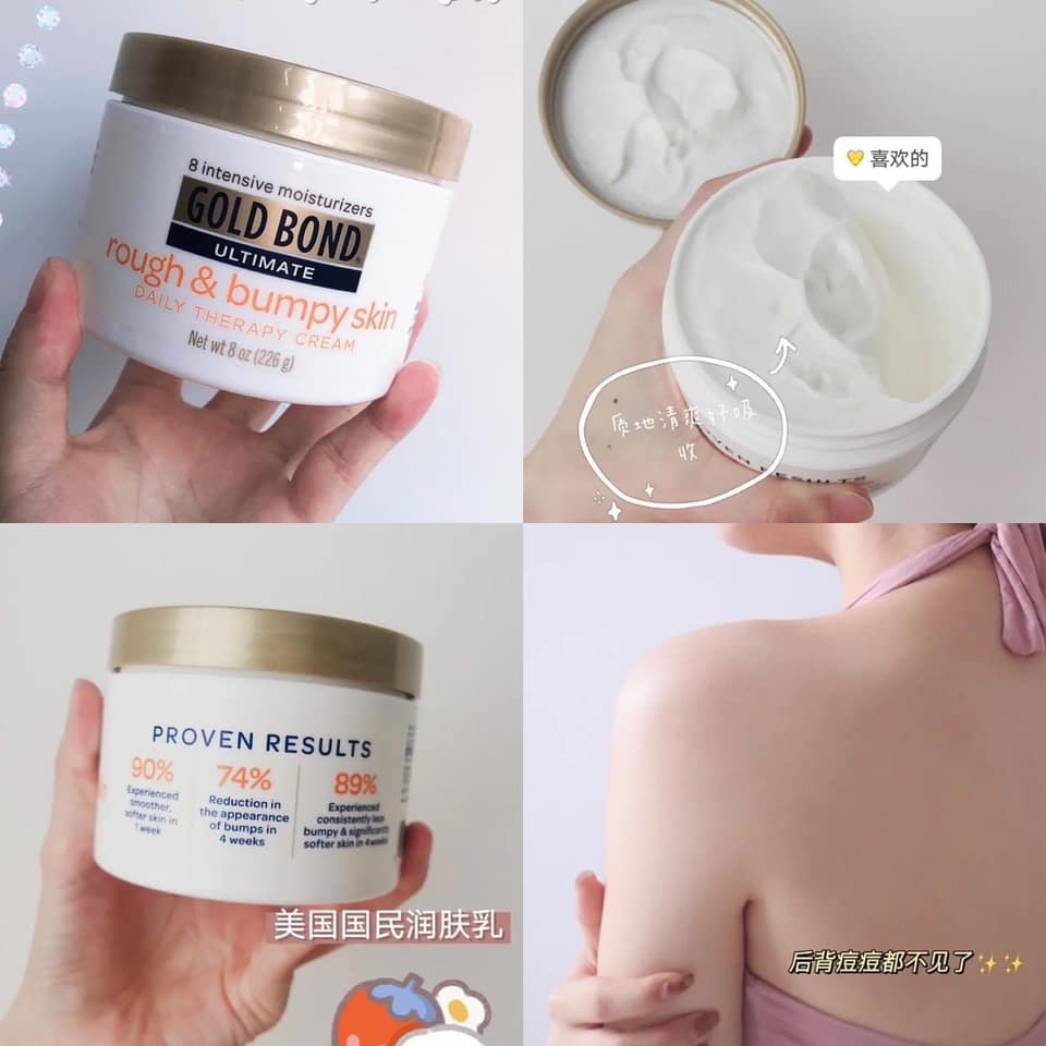 KEM DƯỠNG DA GOLD BOND ULTIMATE ROUGH & BUMPY SKIN 226G