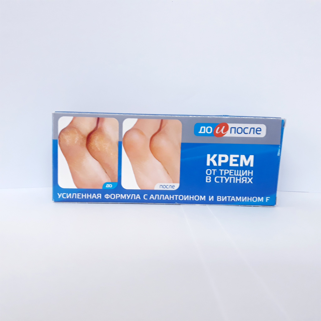 [ Hàng Chính Hãng] Kem Nứt Gót Chân Kpem Nga 50ml