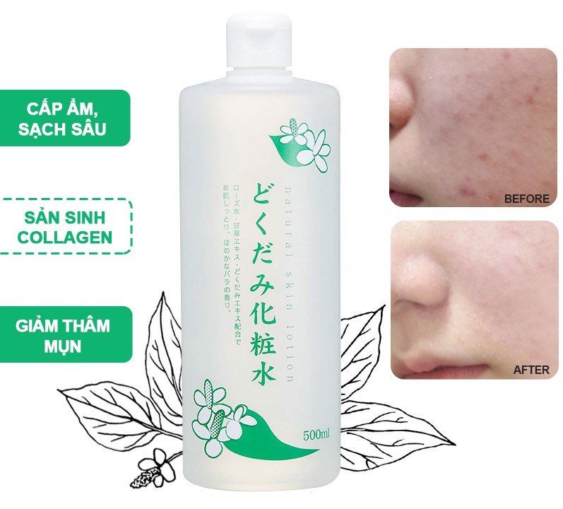 Lotion dưỡng da Dokudami