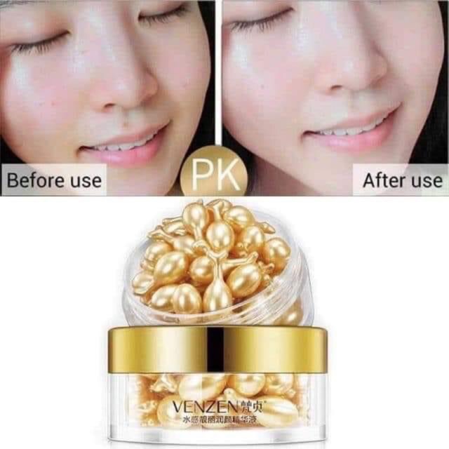 Serum dưỡng da căng bóng VENZEN