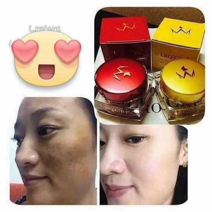 [HCM]Bộ Đôi Kem Nám Tàn Nhang Dưỡng Trắng