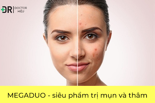 Megaduo New gel- Gel ngừa mụn
