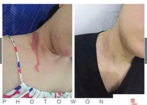 Kem sẹo Gentacin Nhật Bản 10gr