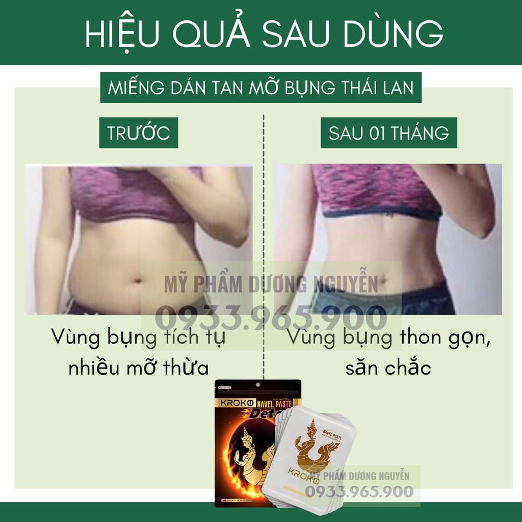 Miếng Dán Tan Mỡ Bụng Kroko Detox Thái Lan Navel Paste