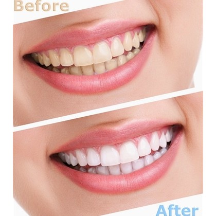 [HCM]Kem đánh răng Colgate Cool Stripe Mỹ 100ml
