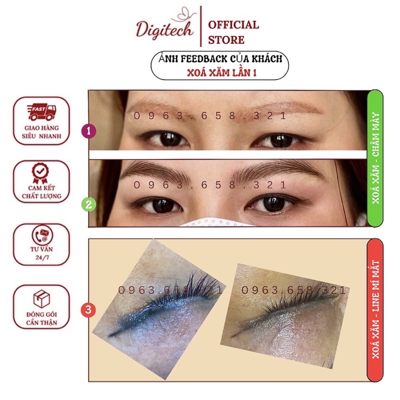 Máy xoá xăm chân mày NEATCELL- Lazer Đỏ