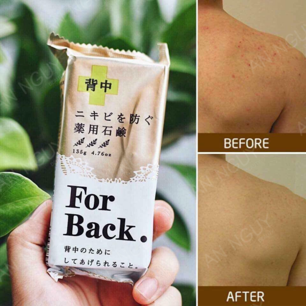 Xà Phòng Giảm Mụn Lưng For Back - Nội địa Nhật Bản