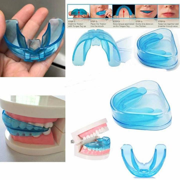 Dụng cụ niềng răng tại nhà
