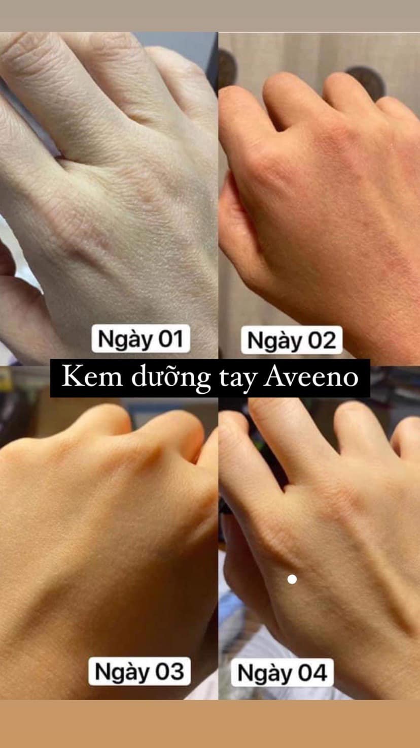 Kem Aveeno Dưỡng Ẩm Da Tay Tuýp 100gr
