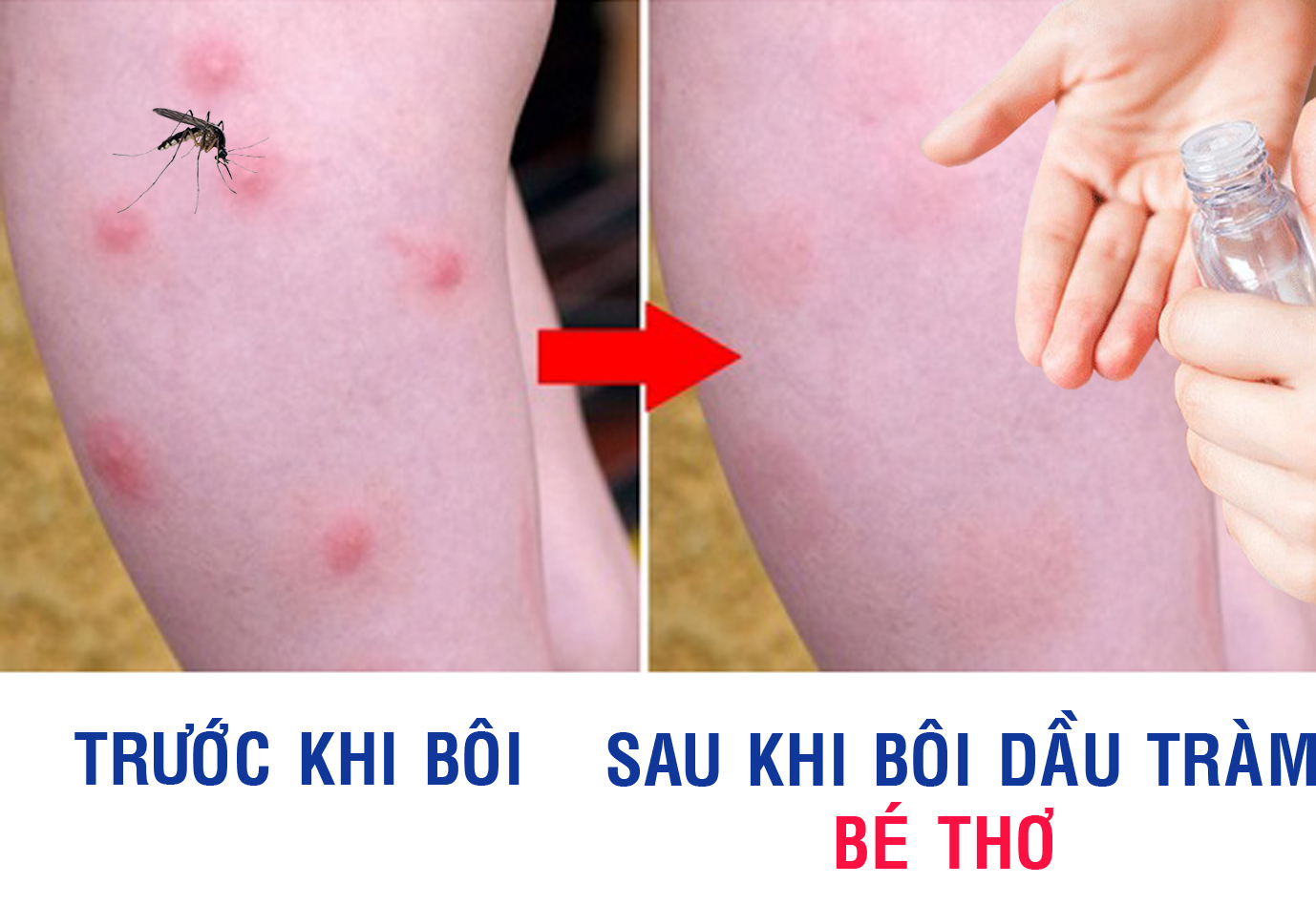 Combo 2 Lọ Dầu Tràm Bé Thơ 50 ml