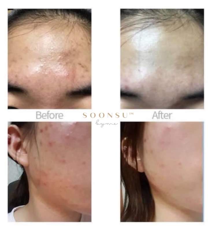 Kem Chấm Mụn Cellmula Ac Clear Spot