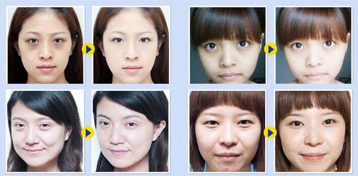 combo 5 mặt nạ mắt collagen CC3.5