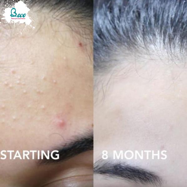 Sữa Rửa Mặt Cetaphil Gentle Skin Cleanser