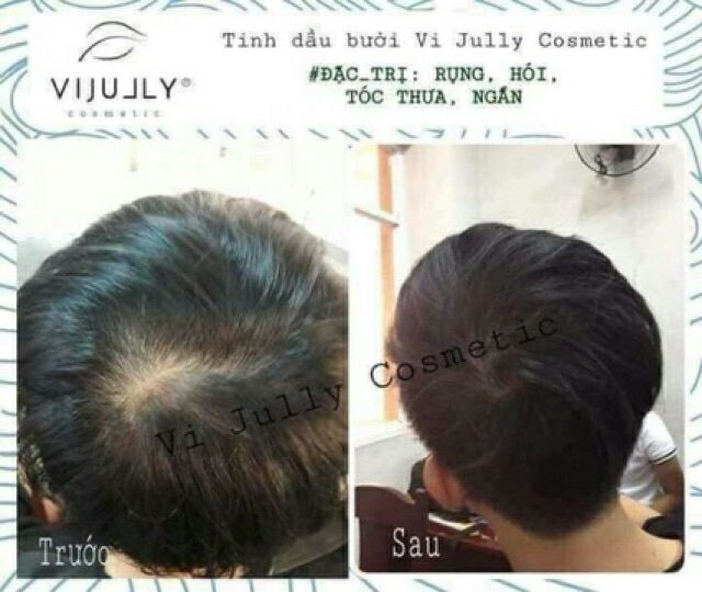 [HCM]Tinh Dầu Bưởi Dưỡng Tóc