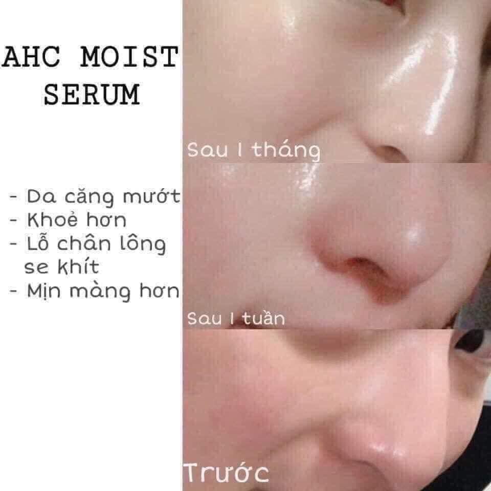 XỊT KHOÁNG AHC - Ahc Royal Truffle Mist Serum