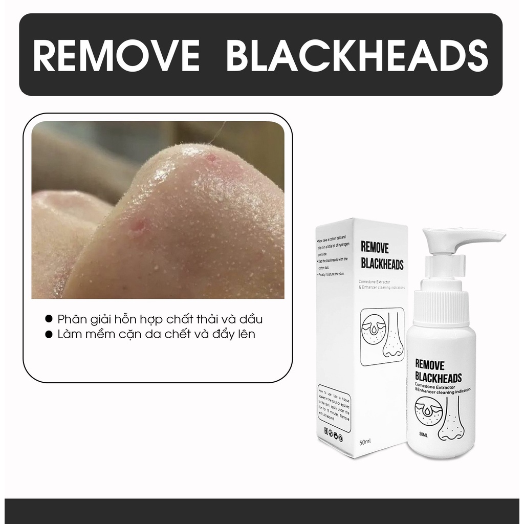 Lọ Dung Dịch Xử Lí Sợi Bã Nhờn Và Mụn Đầu Đen Vùng Mũi Remove Blackheads - Ủ Mụn Remove Blackheads Lepit Cosmetic