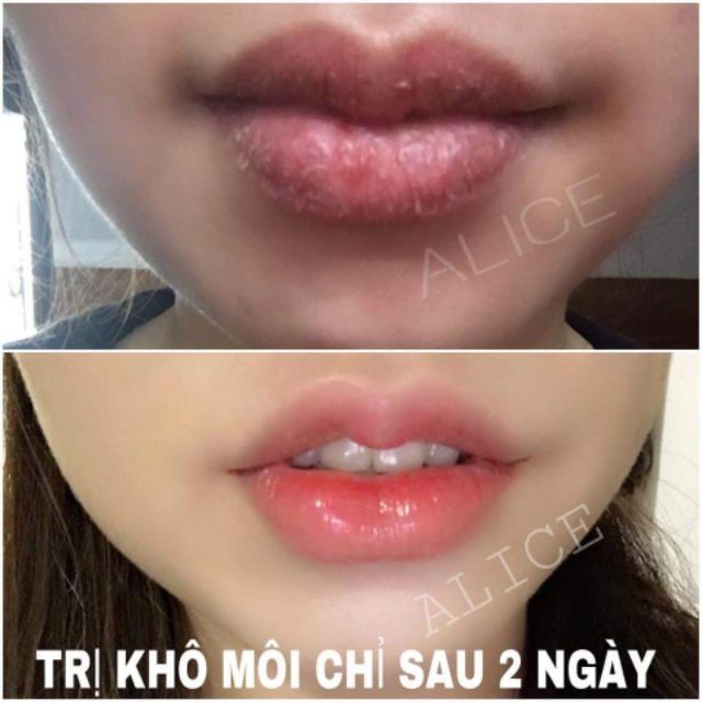 Labocare Panteno Lips Loại Bỏ Tình Trạng Thâm Môi