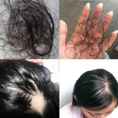 LOREAL AMINEXIL ADVANCED Essence REDUCES LOSS FOR Thin Hair 10 - BOX