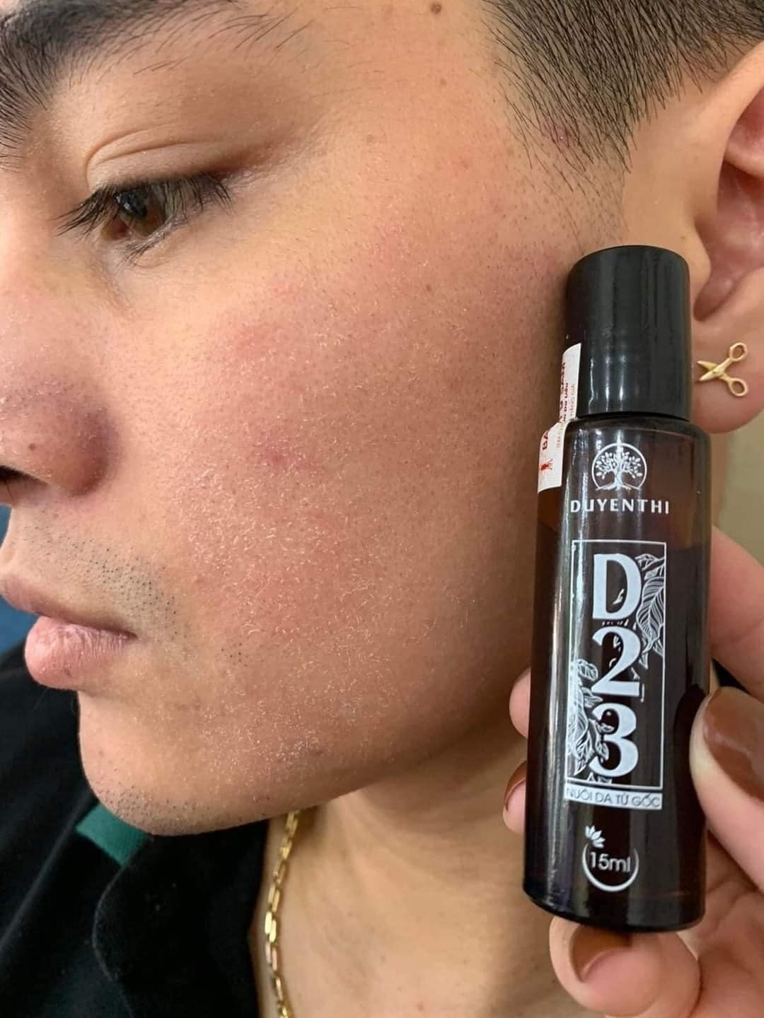 Tái Tạo Da D23 Duyên Thị Bách Y Sâm 15ML Mới