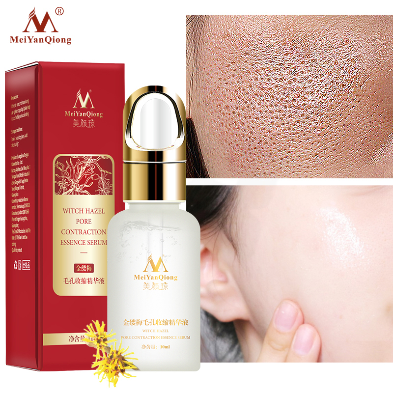 MeiYanQiong Tinh chất serum se khít lỗ chân lông sáng bật tông ngừa mụn kháng viêm