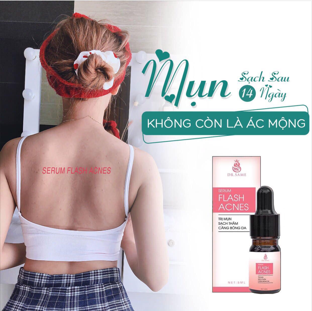 ÁO REN HOA IN HÌNH CÔ GÁI FORM TỪ 35 KG_ 70KG ( ÁO REN _ CÔ GÁI KÍNH ĐEN )