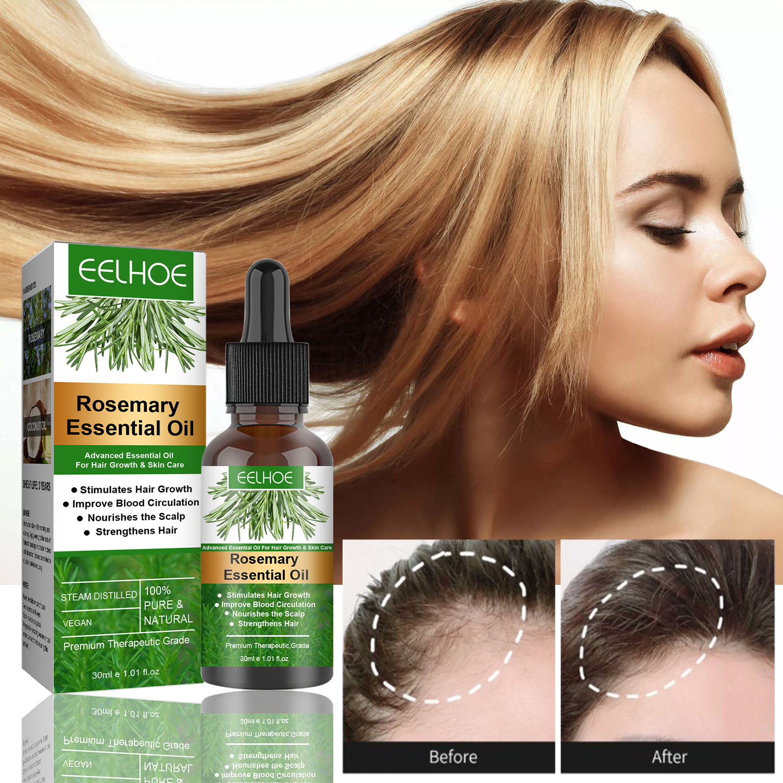 EELHOE Tinh Dầu Xịt Mọc Tóc 30ML Tinh Dầu Dưỡng Tóc Chống Rụng Mọc Tóc