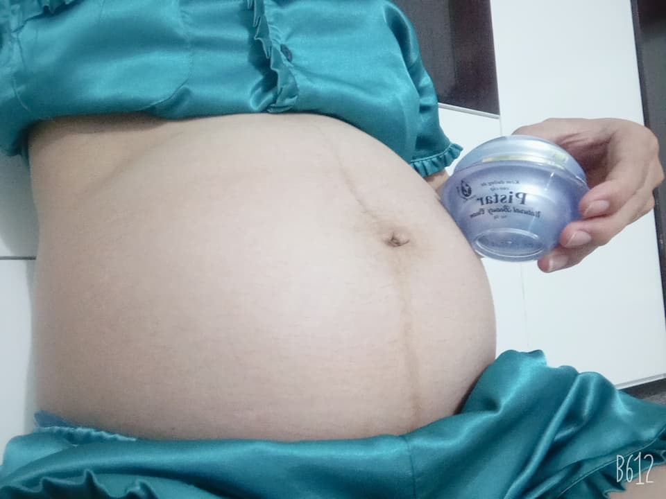 [HCM]KEM NGỪA RẠN DA CHO BÀ BẦU-PISTAR