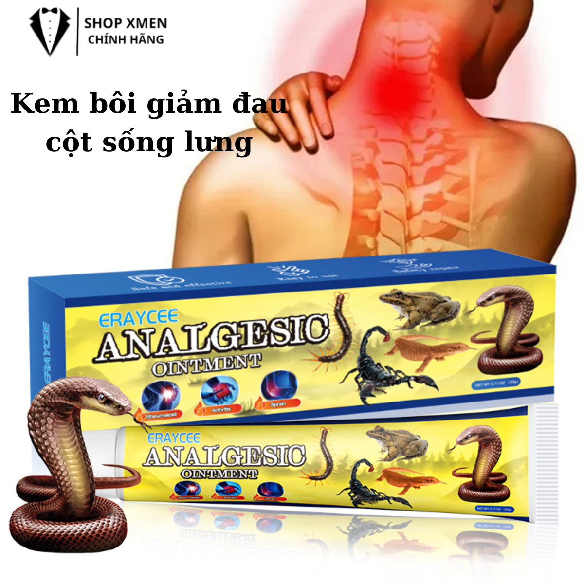 Kem bôi giảm đau cột sống lưng, cổ, thoái hóa đốt sống lưng, thoát vị đĩa đệm, đau nhức xương khớp, giảm đau nhanh chóng.