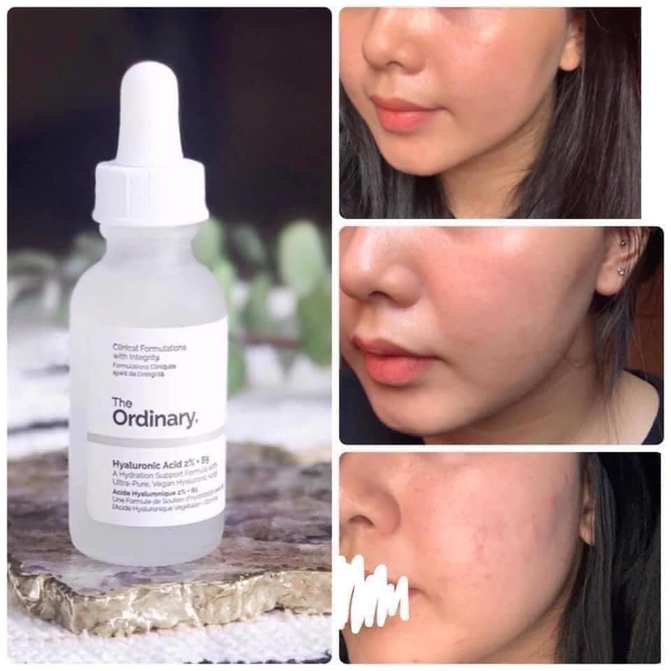 Serum The Ordinary Hyaluronic Acid 2% + B5 tinh chất dưỡng ẩm phục hồi da cấp nước do kích ứng 30ml