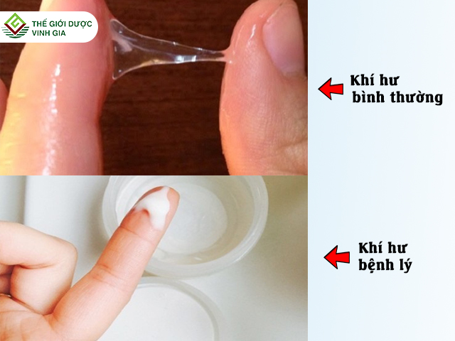 [LẺ 1 VỈ 10 VIÊN] VIÊN ĐẶT ESTORIL 0.5MG NHẬT BẢN