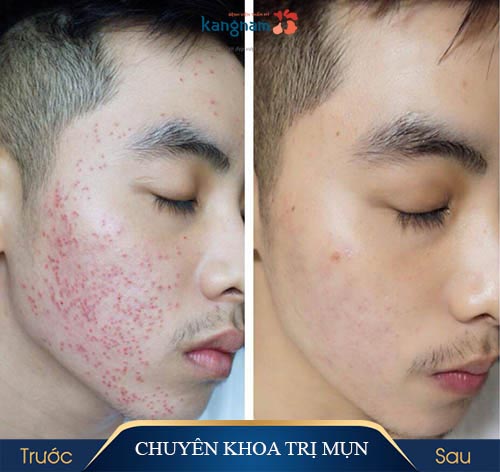 [HCM]Thiên Mộc Sắc dòng tiêu chuẩn 30ml 50ML 100ML