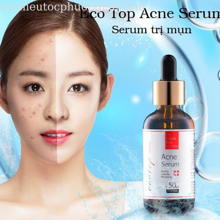 Serum làm giảm mụn ECOTOP