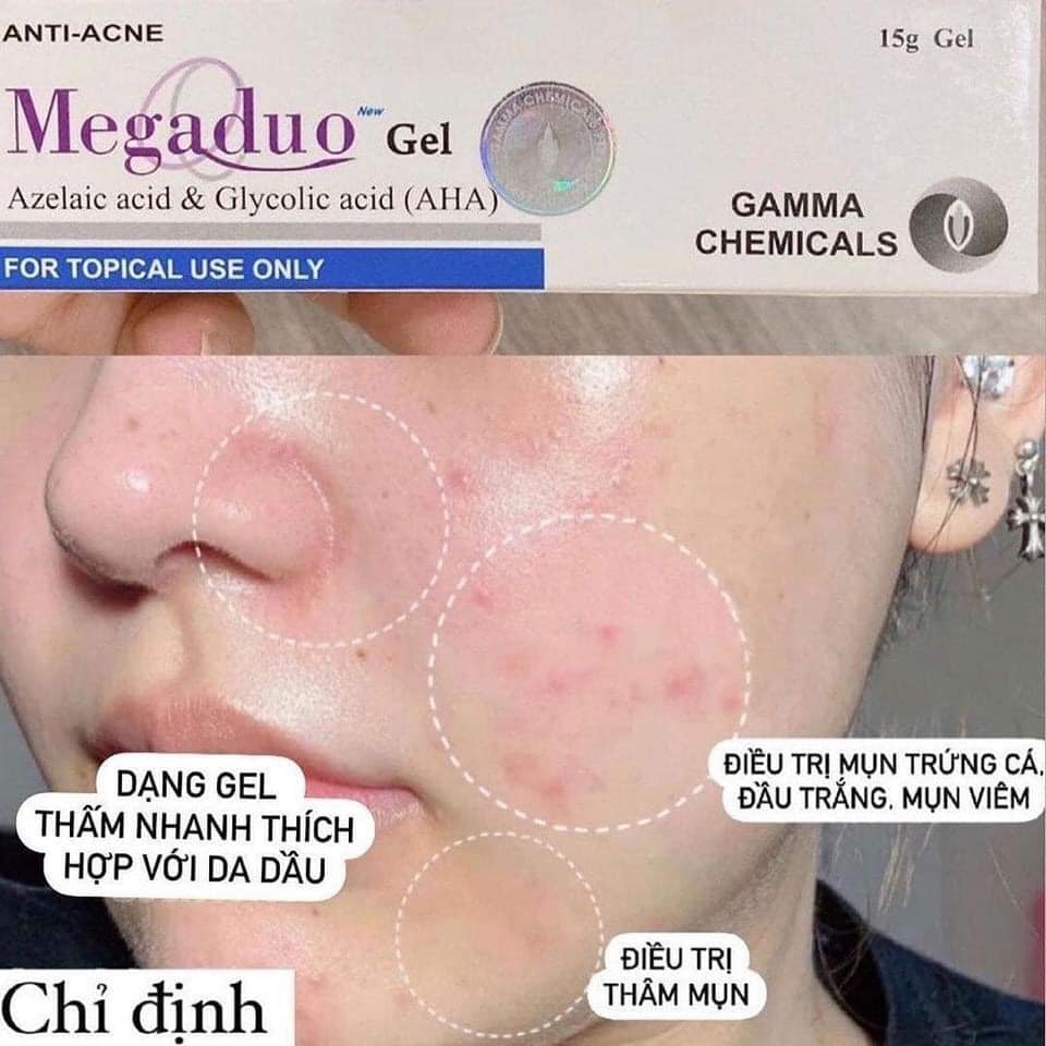 Gel TRỊ Mụn Trứng Cá Megaduo 15g