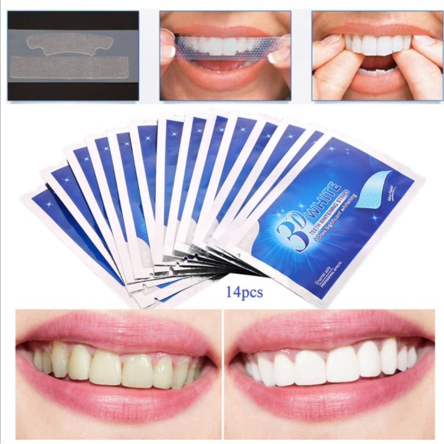 Miếng dán làm trắng răng 3D