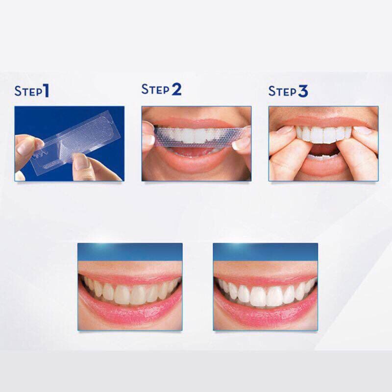 Practical high quality 3D teeth whitening patch